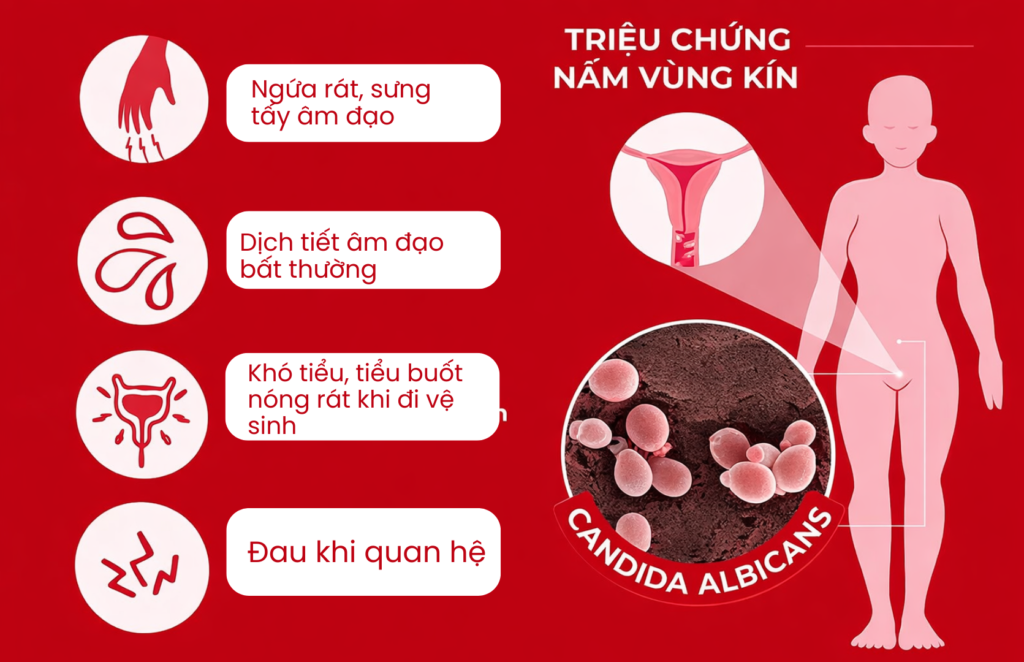 Mô tả hình ảnh: Hình ảnh thuốc kháng nấm và quần lót cotton, minh họa các phương pháp điều trị hiệu quả.
