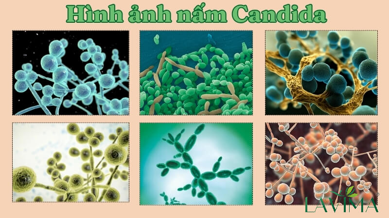 Mô tả hình ảnh: Hình ảnh minh họa về nấm candida dưới kính hiển vi.
